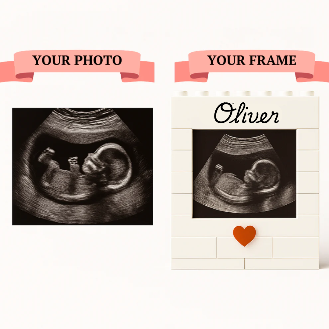 Custom Ultrasound Brick Set